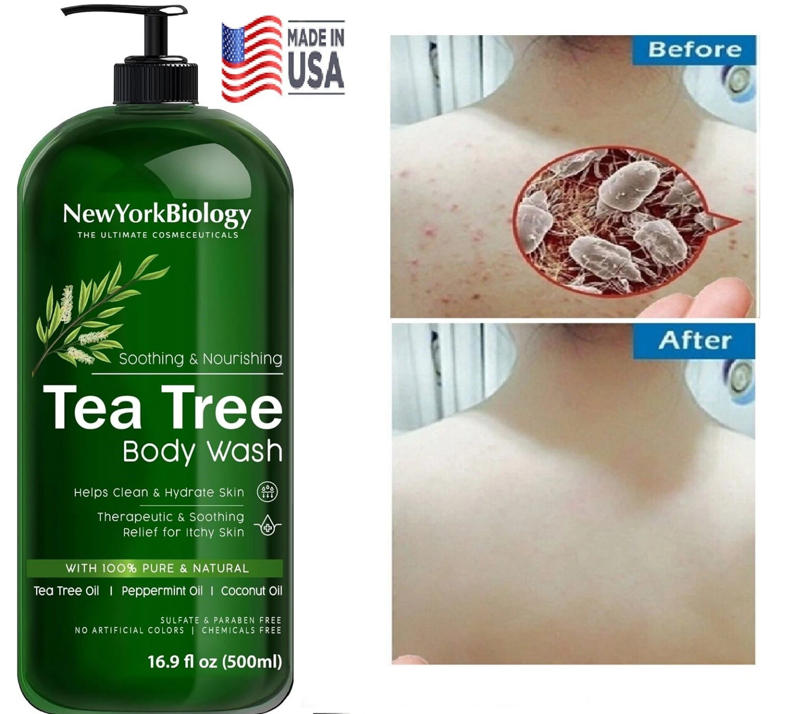 Therapeutic Soap Antifungal and Antibacterial Body Eliminate Fungus Ringworm US