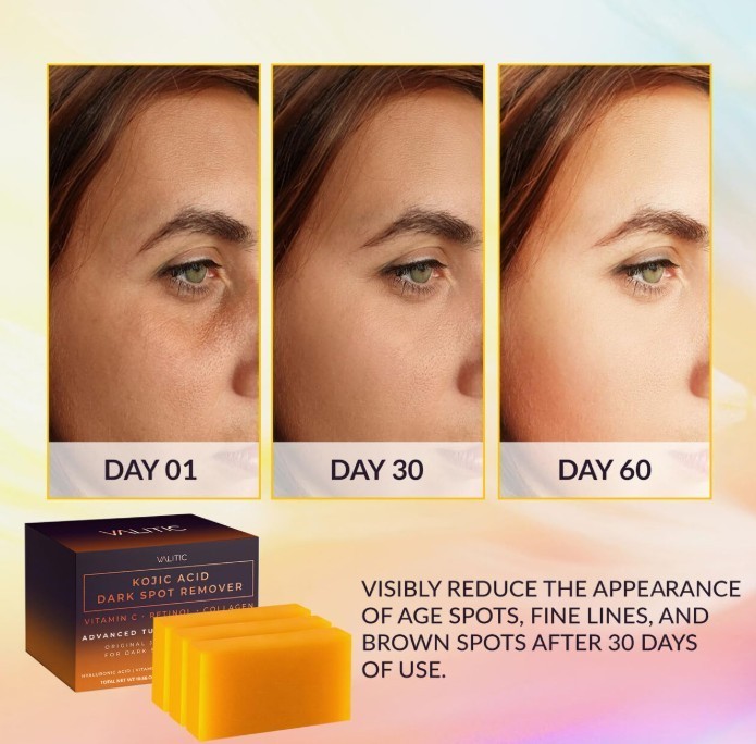 3Pcs Kojic Acid Turmeric Soap Bar Dark Spot Remover Vitamin C Retinol