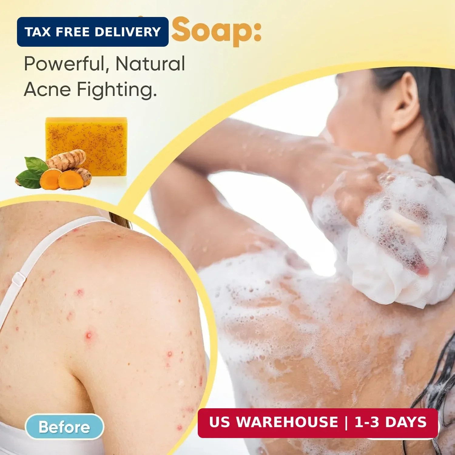 5 Jabones De Curcuma 3.5 Oz Para Las Manchas El Acne En La Cara Y Aclarar Piel