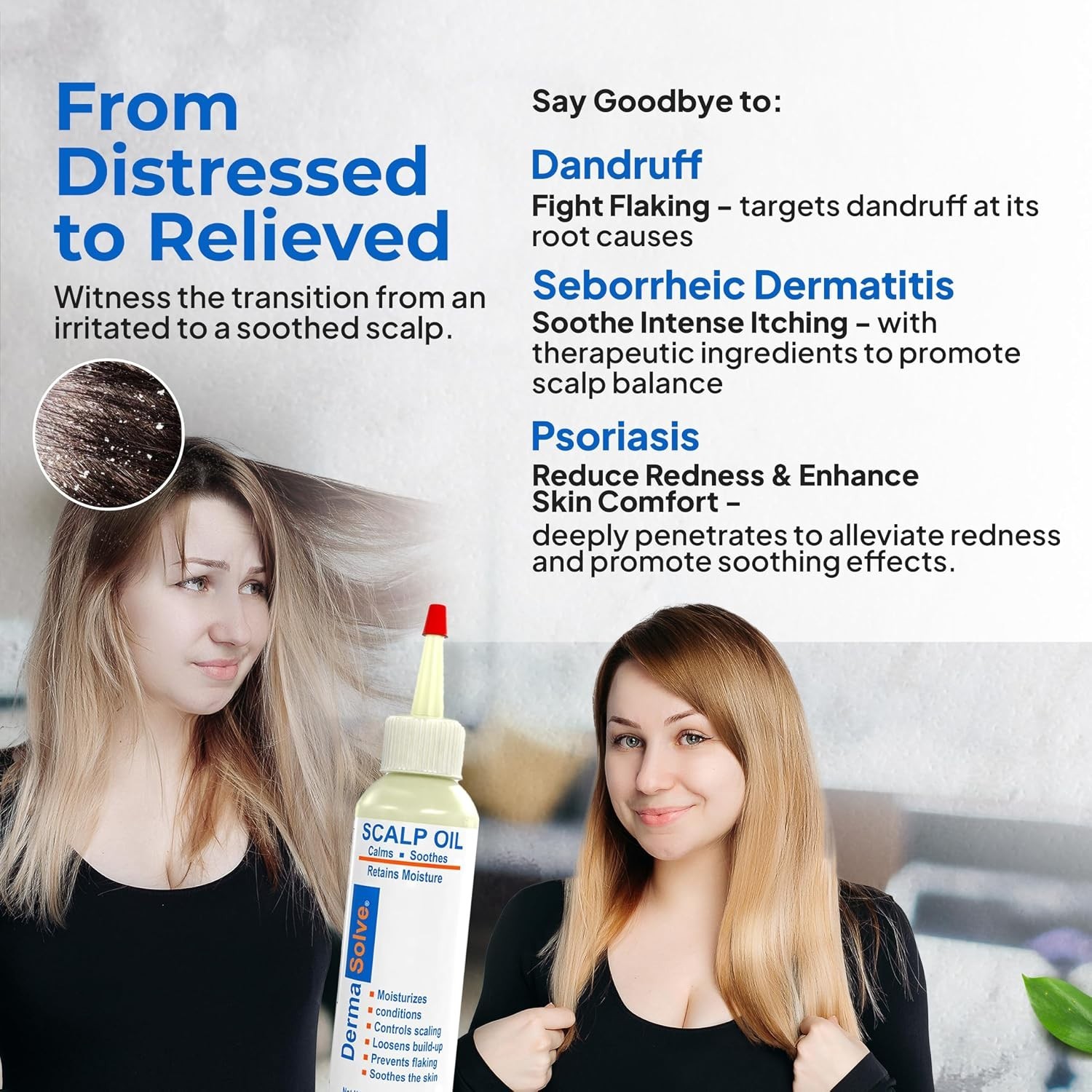 Psoriasis & Dandruff Oil, Dermatologist Approved for Flaky Scalp Relief