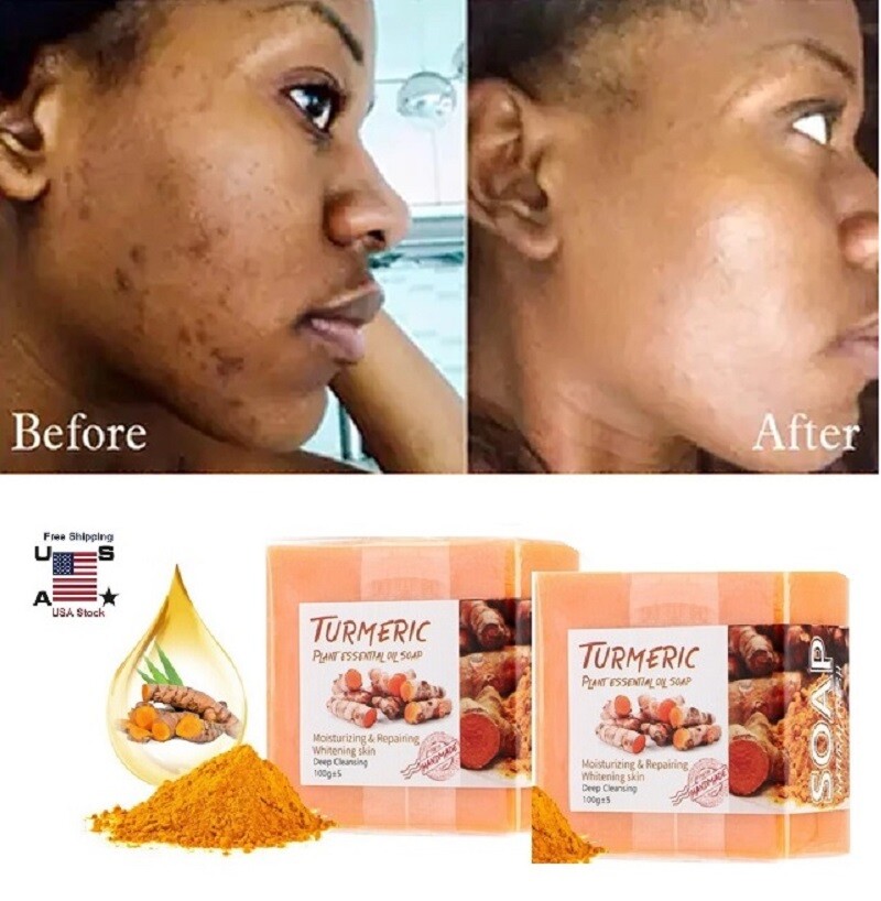 umeric Soap Skin Whitening Dark Spots lightening Acne Brightening Turmeric