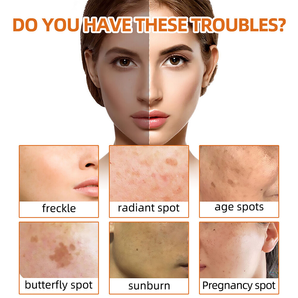 umeric Soap Skin Whitening Dark Spots lightening Acne Brightening Turmeric