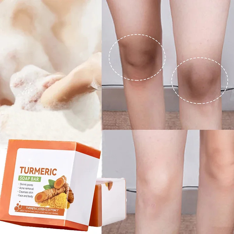 Hand Made Turmeric Soap Body Cleaning Lightening Dark Underarm Leg Body Cleanser