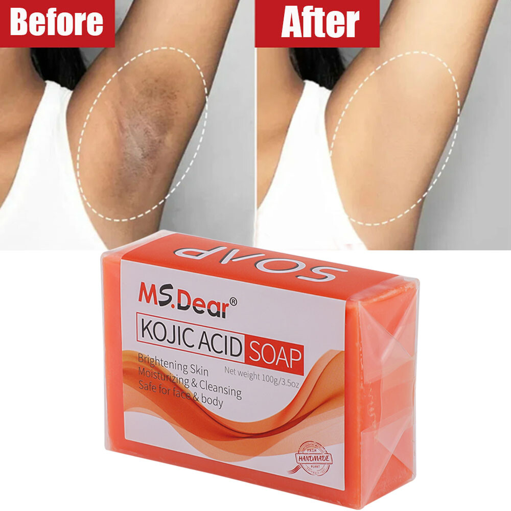 Kojic Acid Soap Dark Skin Whitening Bleaching Lightening Brightening Face & Body
