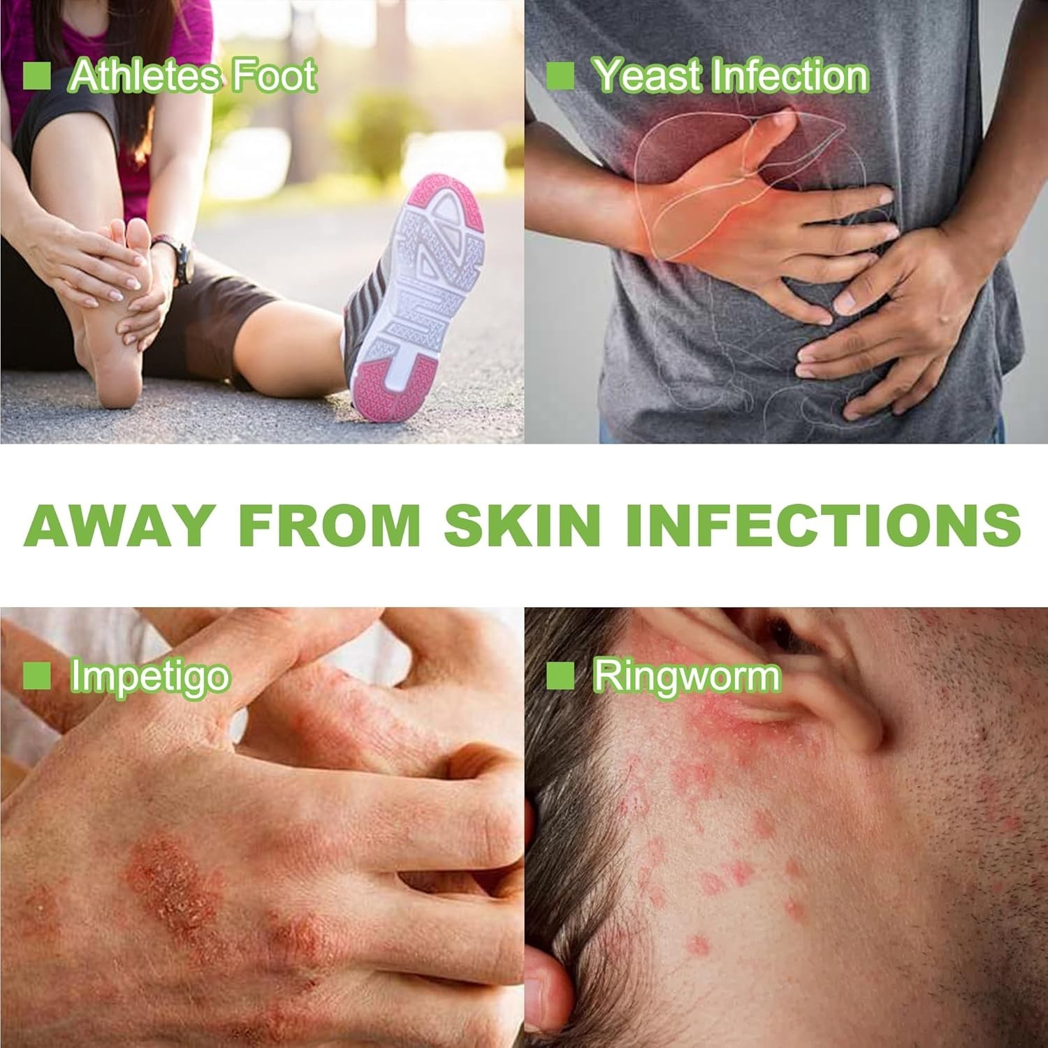 Antifungal Medicated Soap Bar, Athletes Foot Jock Itch Ringworm Yeast Infection