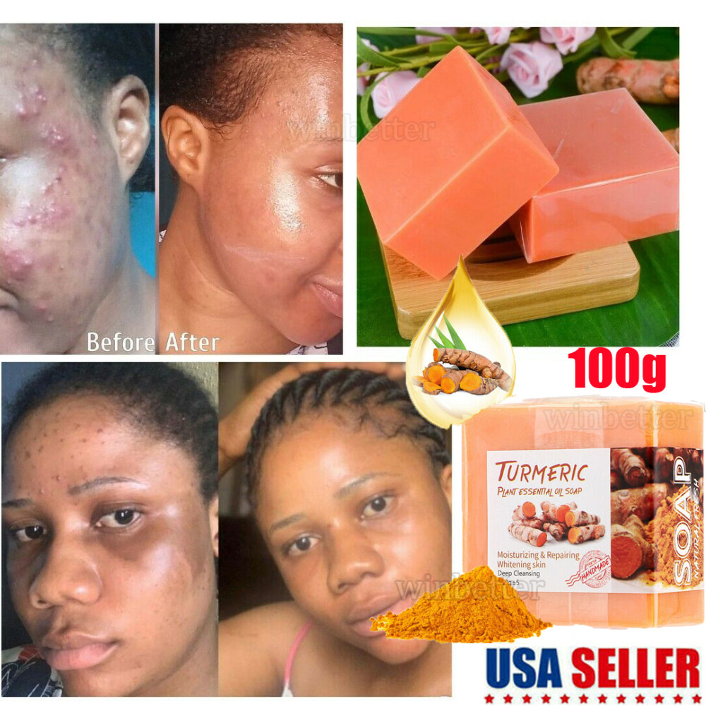 1-5 Pack Tumeric Soap Acne Dark Spots Removal Skin Whitening Body Bleaching Soap