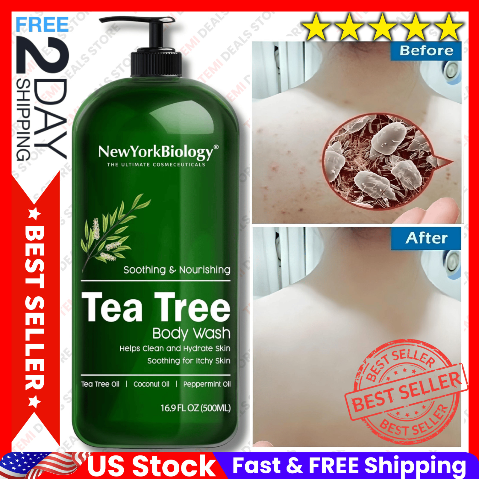 Therapeutic Soap Antifungal and Antibacterial Body Eliminate Fungus Ringworm Acn