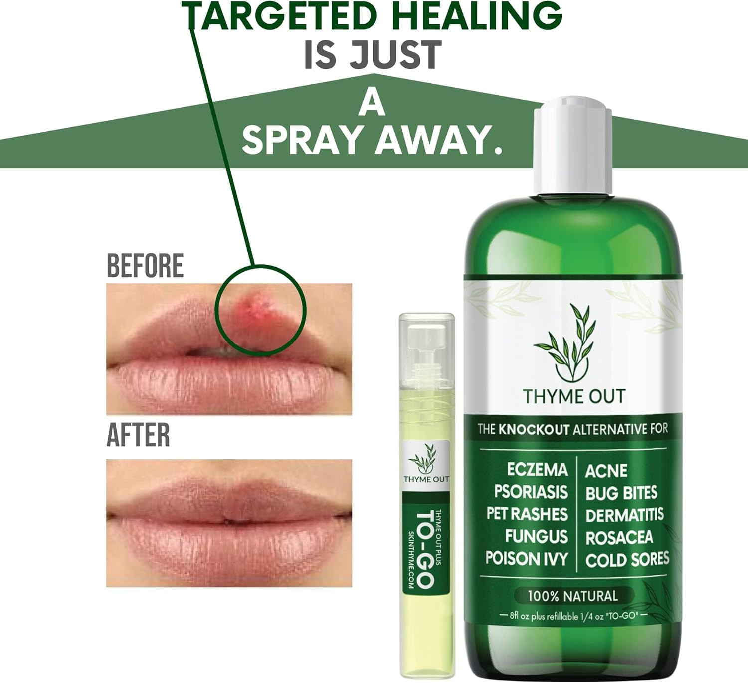 All Natural Eczema Treatment- Psoriasis Treatment – an All-In-One Solution for A