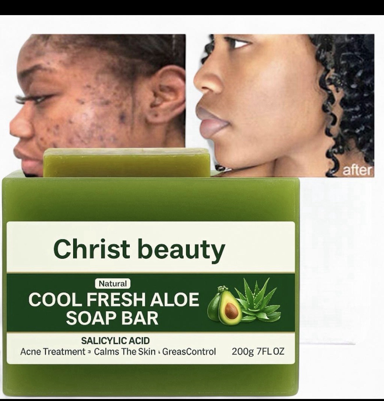 Aloe & Avocado Facial Soap 100g | Daily Cleansing Bar