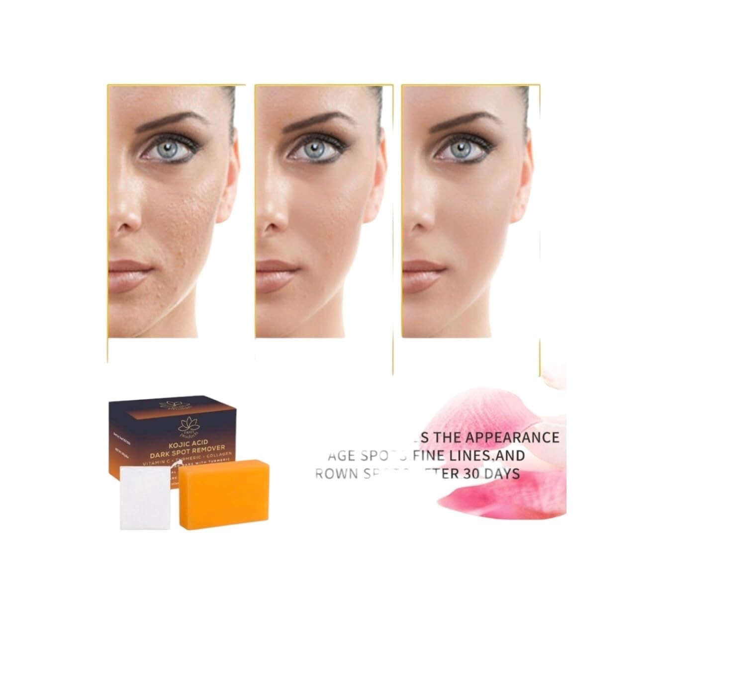 Kojic Acid Dark Spot Remover Soap Bars Vitamin C, Turmeric, Collagen 100g bar
