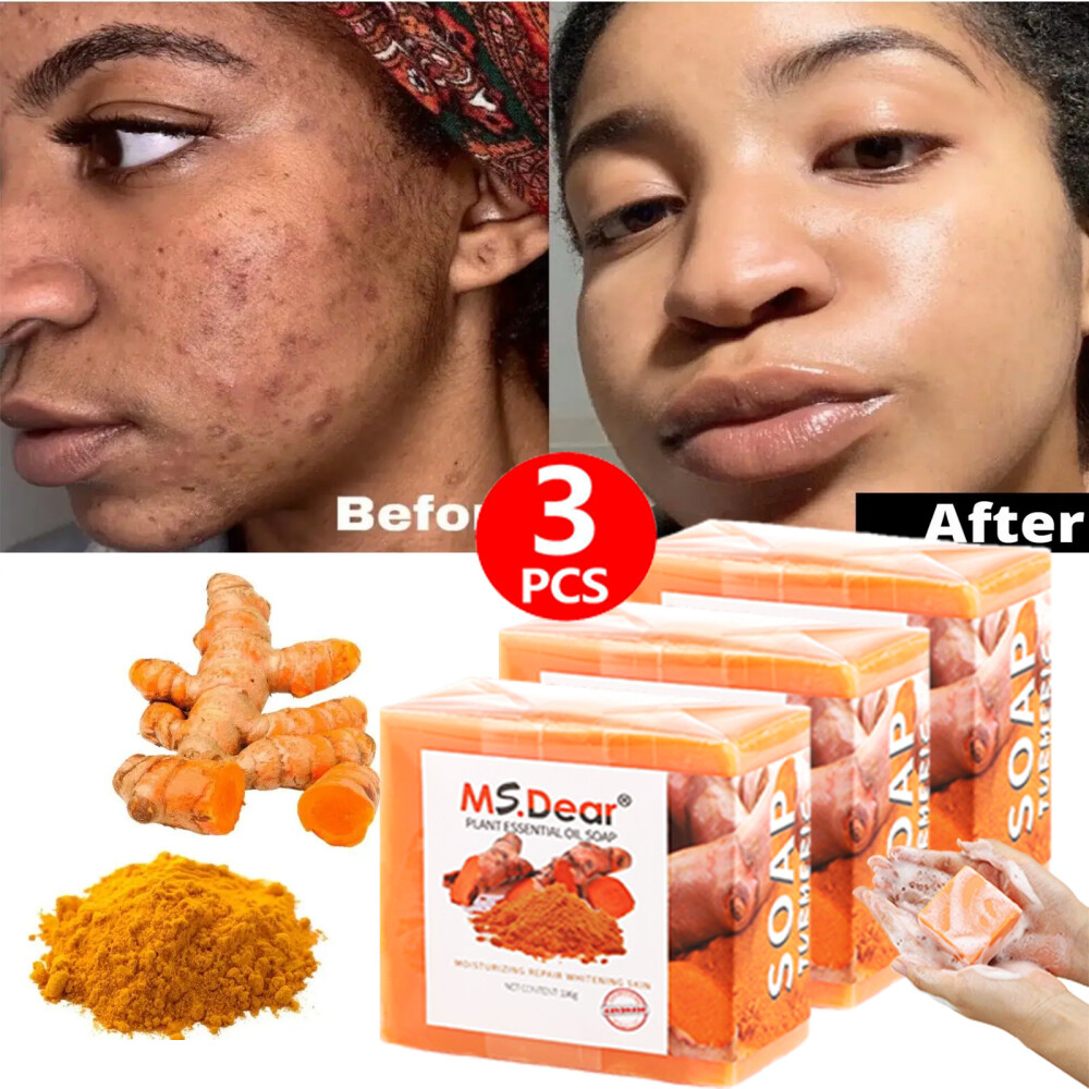3PCS Turmeric Soap Skin Whitening Dark Spots Lightening Acne Brightening Tumeric