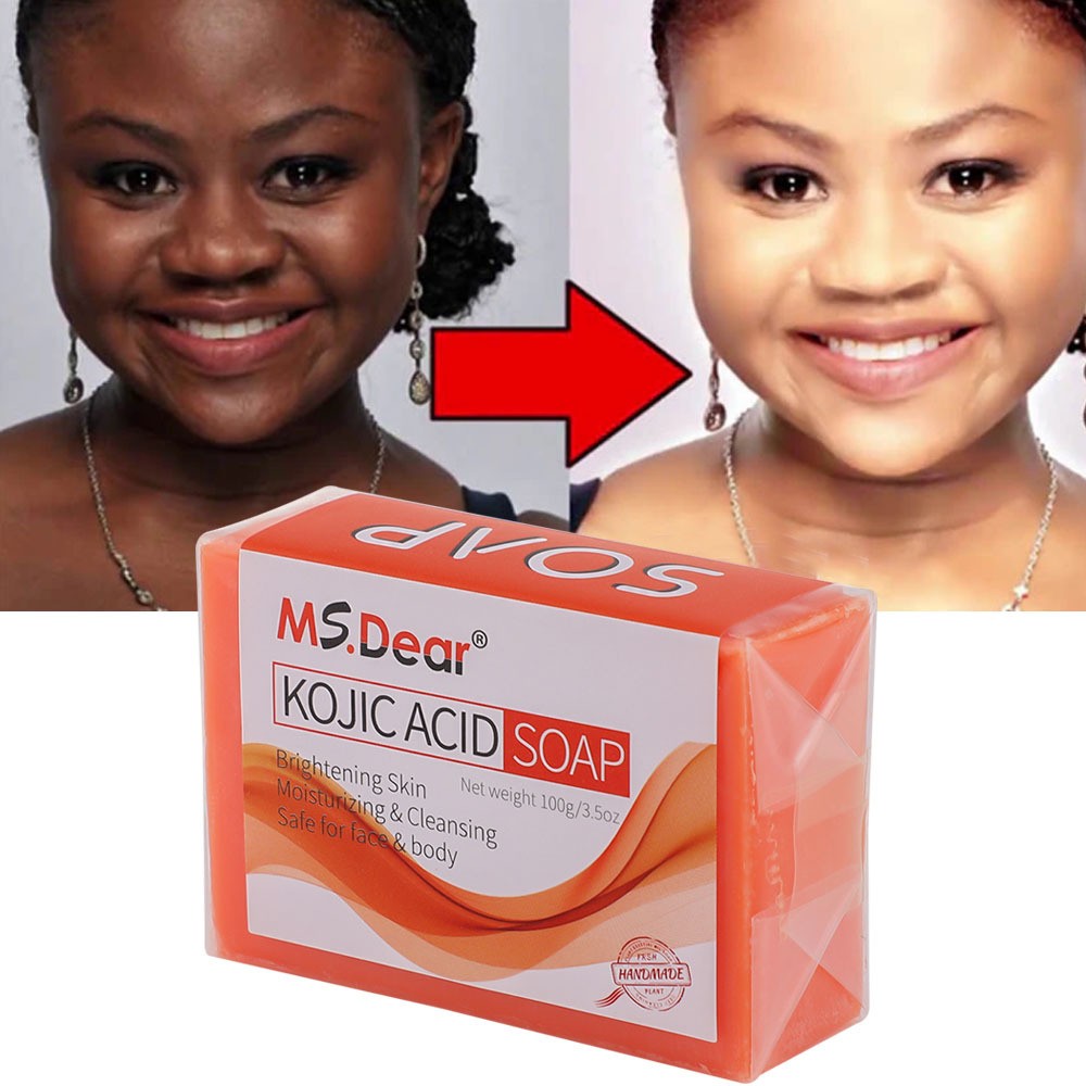 5/3X Kojic Acid Soap Acne Dark Spot Remover Skin Lightening Whitening Face Body
