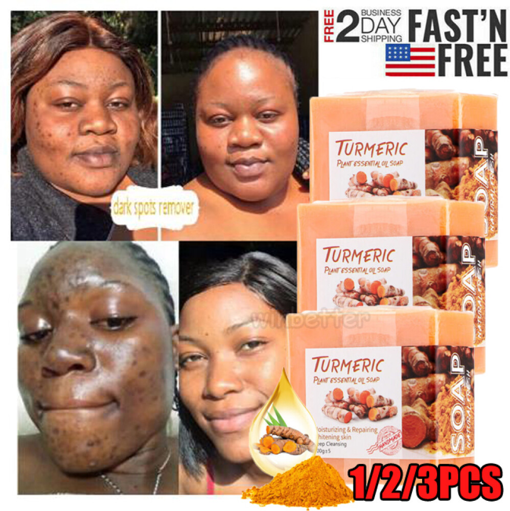 1-5 Pack Tumeric Soap Acne Dark Spots Removal Skin Whitening Body Bleaching Soap