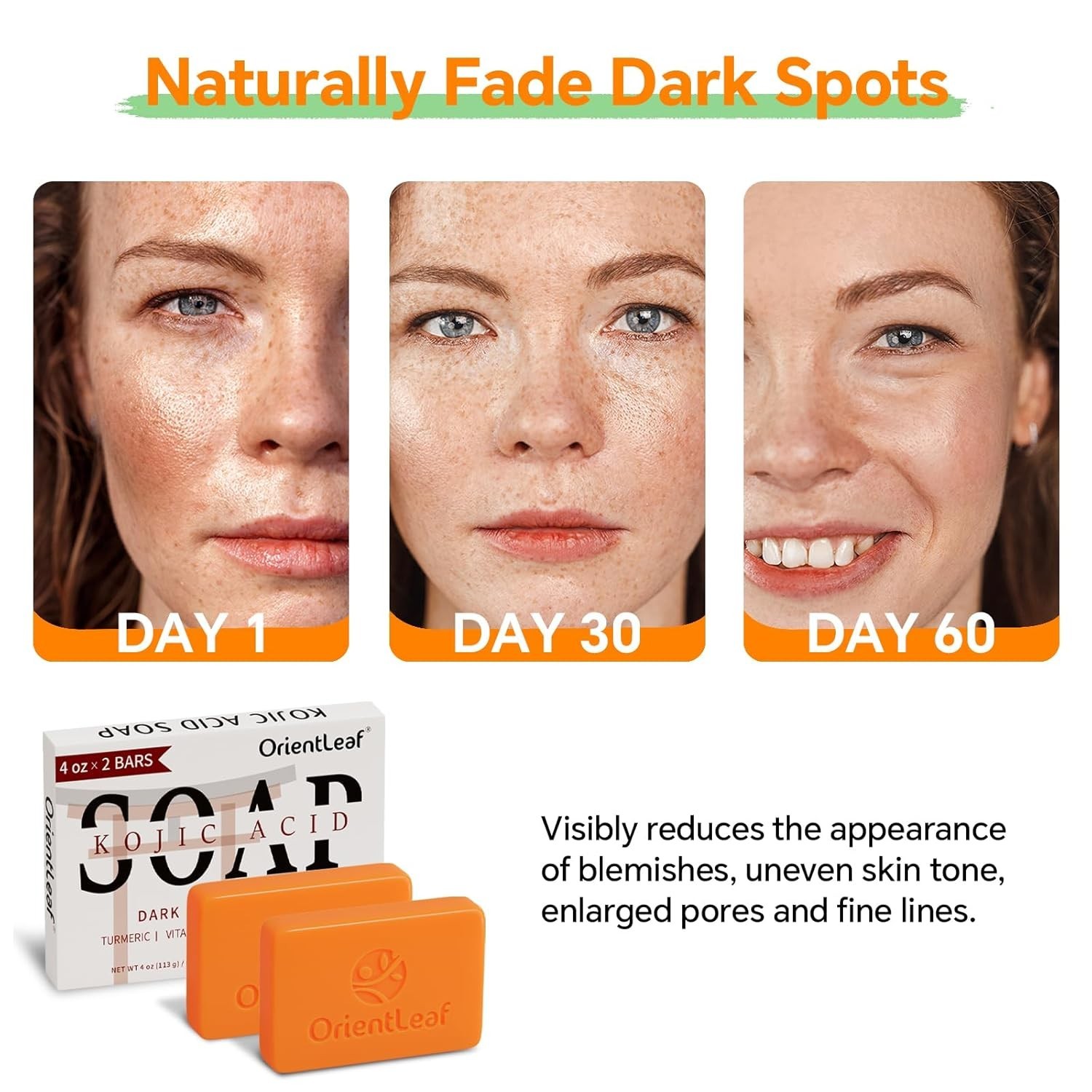 Hydrating Kojic Acid and Turmeric Soap: Brightening & Gentle for All Skin Types