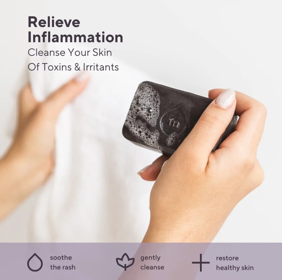 Marie Originals Natural Eczema Soap – Psoriasis, Dermatitis, Dry Skin Care 3.5oz