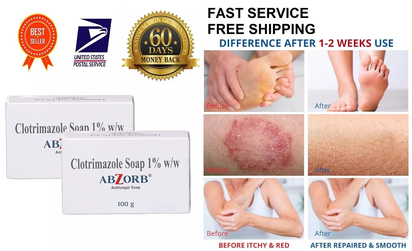 Abzorb Antifungal Absorb Soap – Effective Fungal Protection – 100g(Pack of 2)