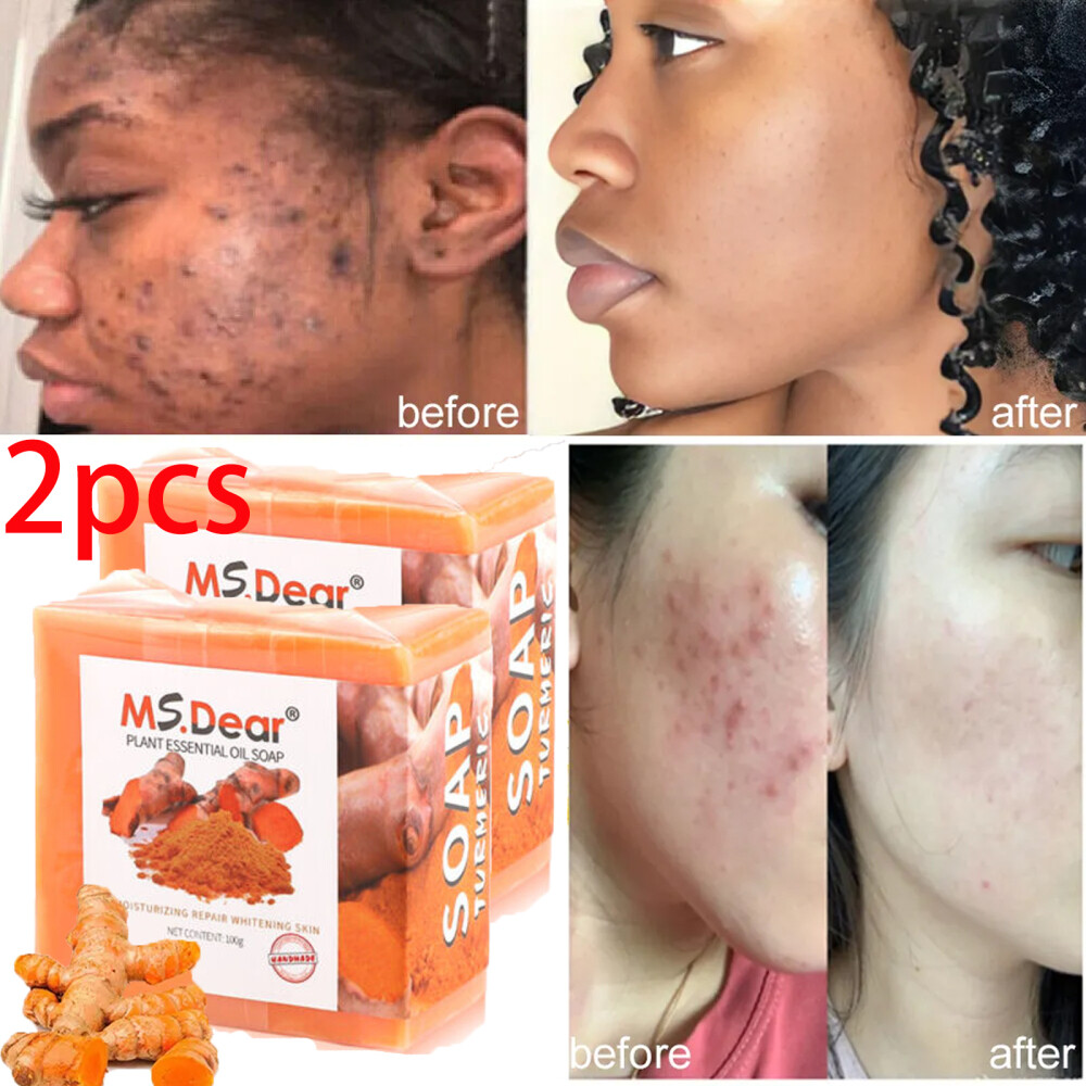 2pcs Tumeric Soap Skin Whitening Dark Spots lightening Acne Brightening Turmeric