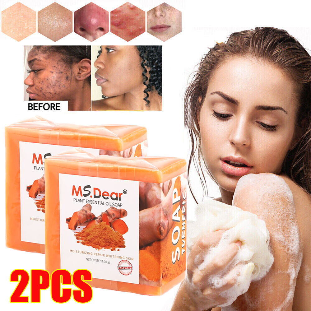 2Pcs Tumeric Soap Skin Whitening Dark Spots lightening Acne Brightening Turmeric