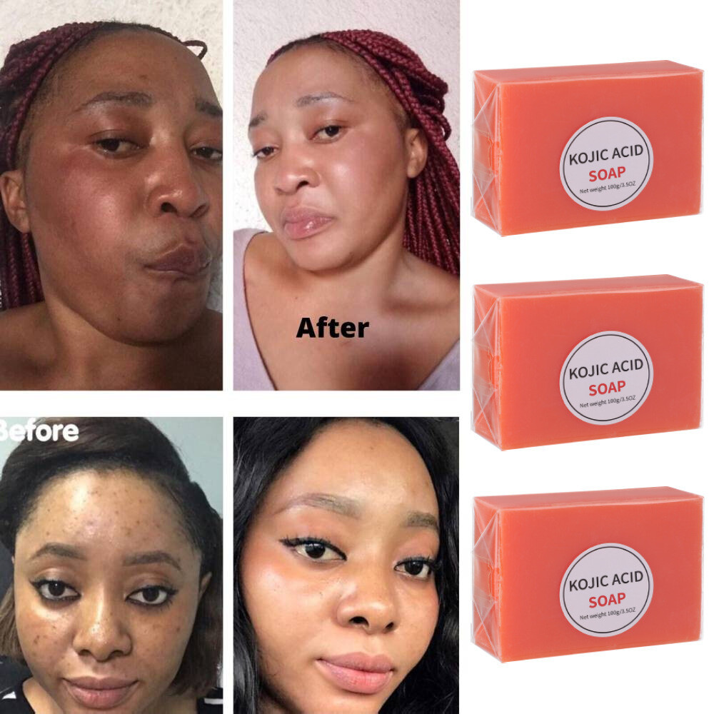 3x Skin Brightening Soap Original Kojic Acid Soap for Dark Spot Whitening 100g