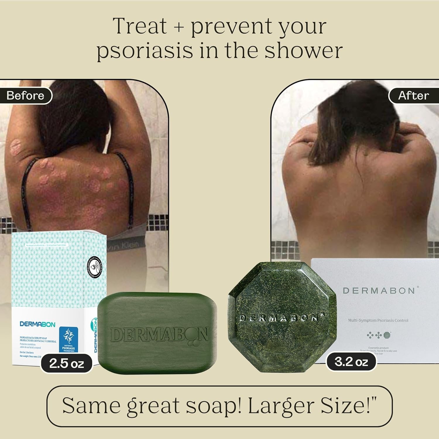 Dermabon Psoriasis Cleanser, Seborrheic Dermatitis Eczema Soap Bar for Adult…