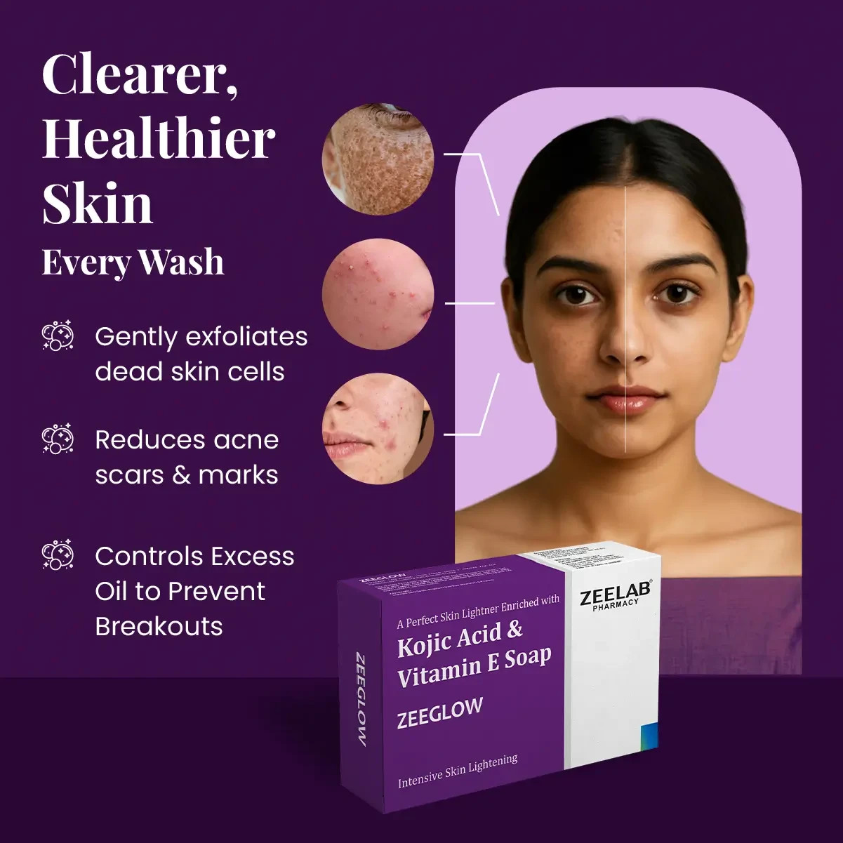 Kojic Acid & Vitamin E Soap Helps Reduce Pigmentation & Uneven Tone Pack of 3