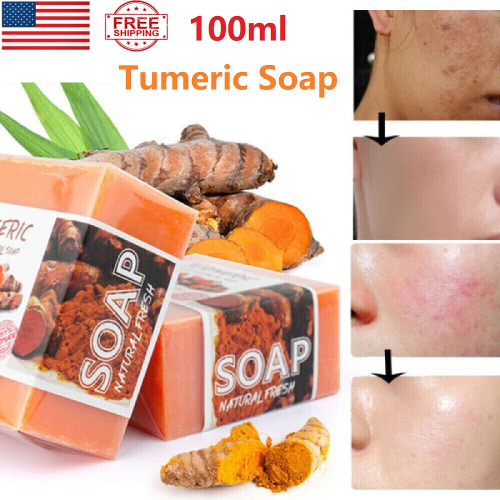 3PCS Tumeric Soap Skin Whitening Dark Spots lightening Acne Brightening Turmeric