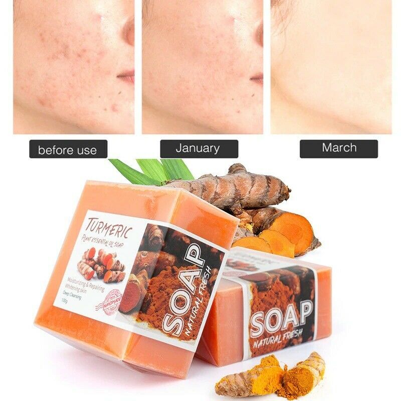Tumeric Soap Skin Whitening Dark Spots lightening Acne Brightening Turmeric USA