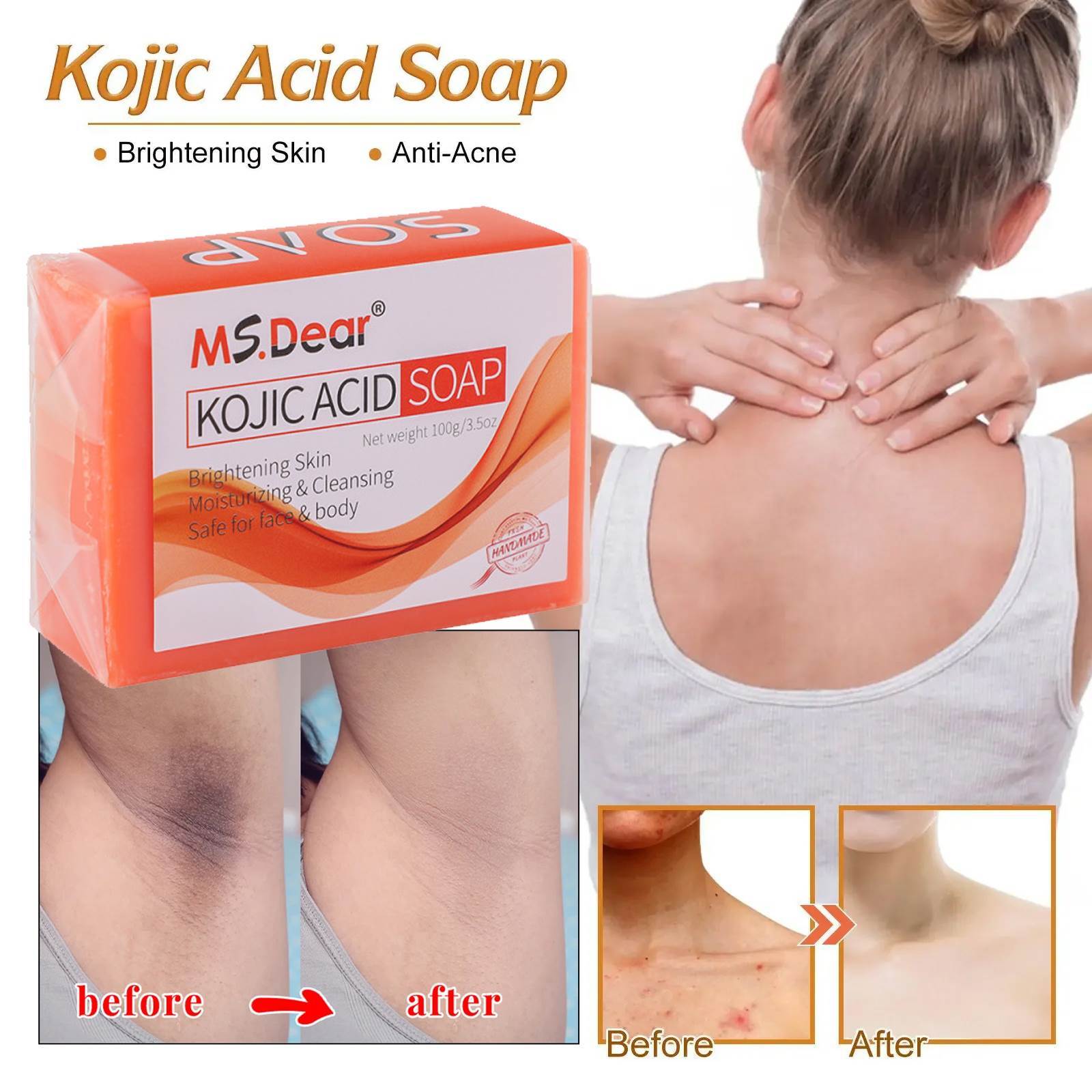 Kojic Acid Soap Dark Skin Whitening Bleaching Lightening Brightening Face & Body