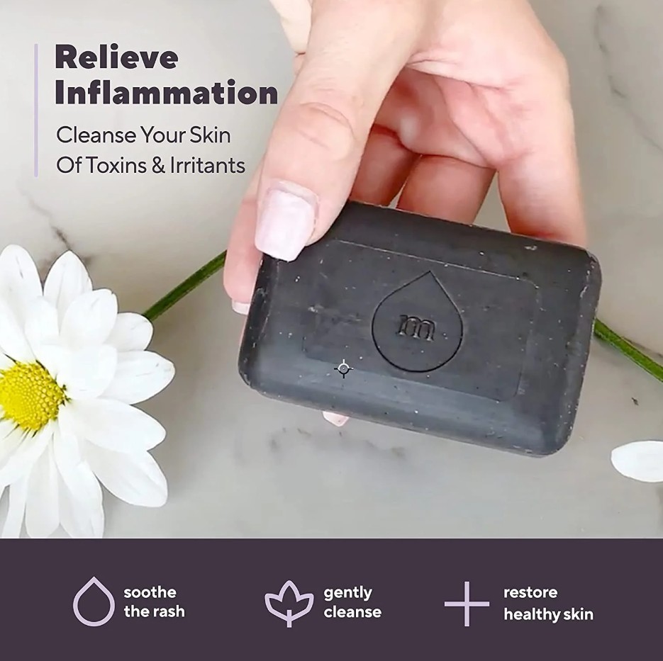 Marie Originals Natural Eczema Soap – Psoriasis, Dermatitis, Dry Skin Care 3.5oz
