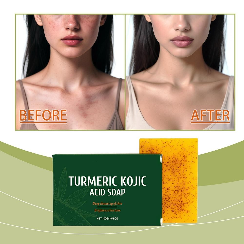 Turmeric Kojic Acid Soap Dim Spot Whiteninsideg Lightening Skin Soap 100g