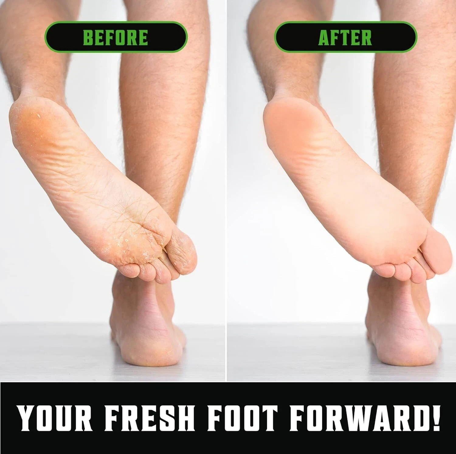 Antifungal Tea Tree Oil Body Wash Soap for Men – Helps Athletes Foot Toenail
