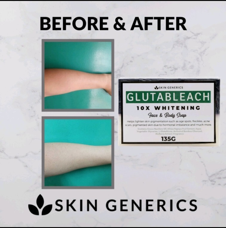 Skin Generics GLUTABLEACH 10X Whitening Face & Body Soap 135g