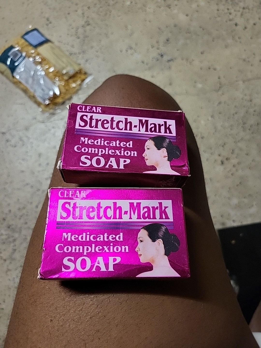 Clear Stretch Mark Medicated Soap 80g 2 Bars