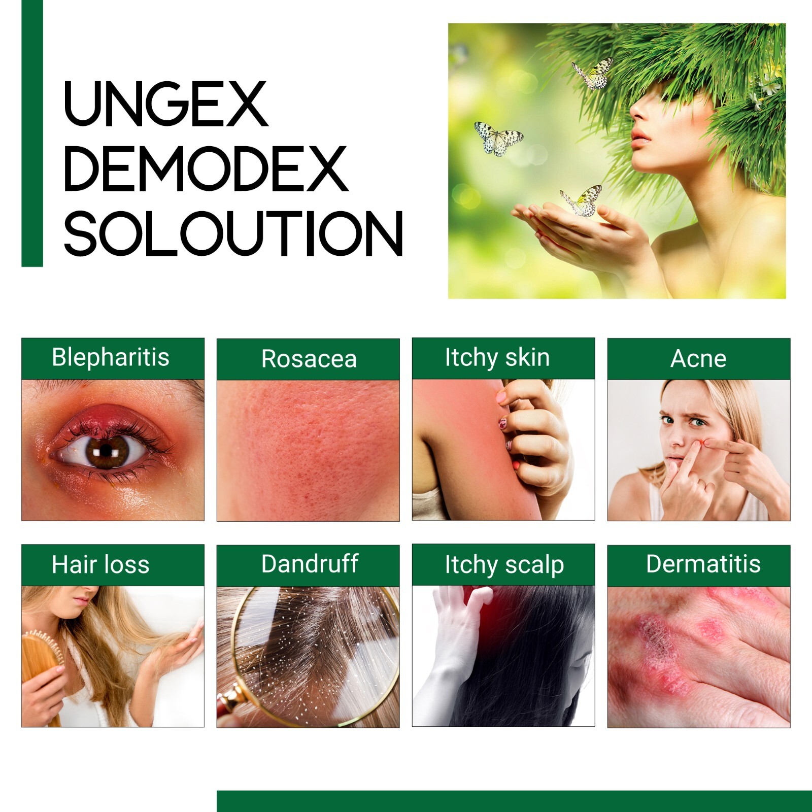 Treat Demodex Acne Rosacea Chalazion Blepharitis | Demodicosis Human Skin Mites