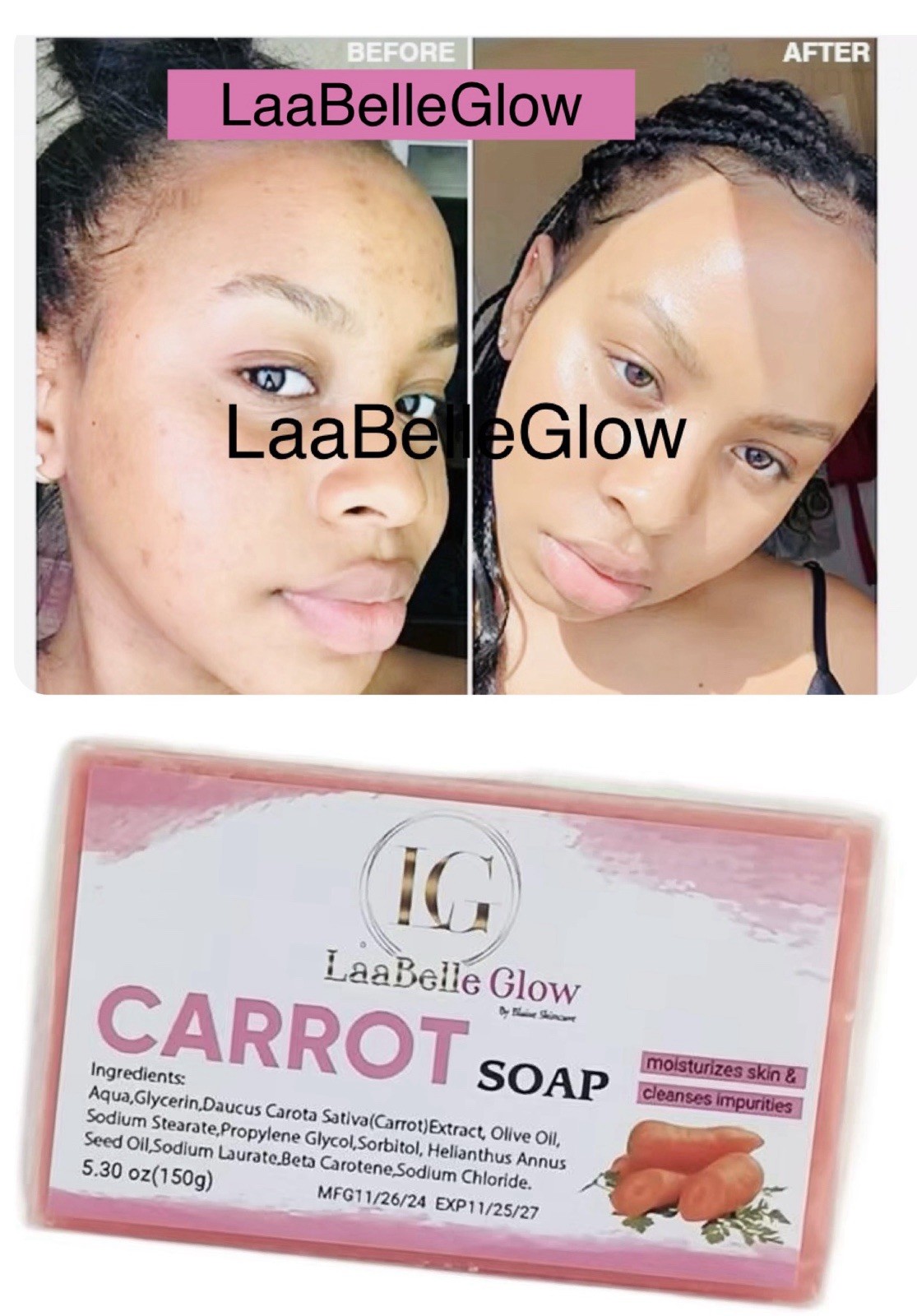 Carrot Soap Skin Whitening Dark Spots Acne Brightening-Glossy 150G