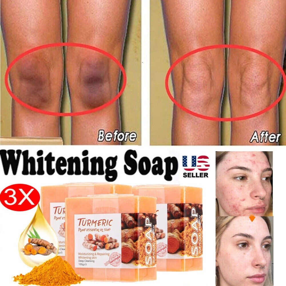 3PCS Tumeric Soap Skin Whitening Dark Spots lightening Acne Brightening Turmeric
