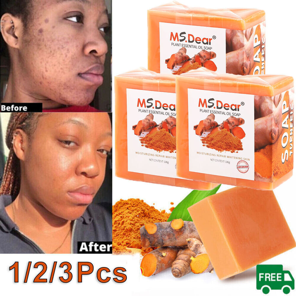 Ms.Dear 100g Tumeric Soap Skin Whitening Dark Spots lightening Acne Brightening