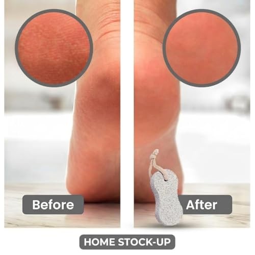 Pumice Stone Pack of 2 Natural Volcanic Stones for Gentle Exfoliation, Callus