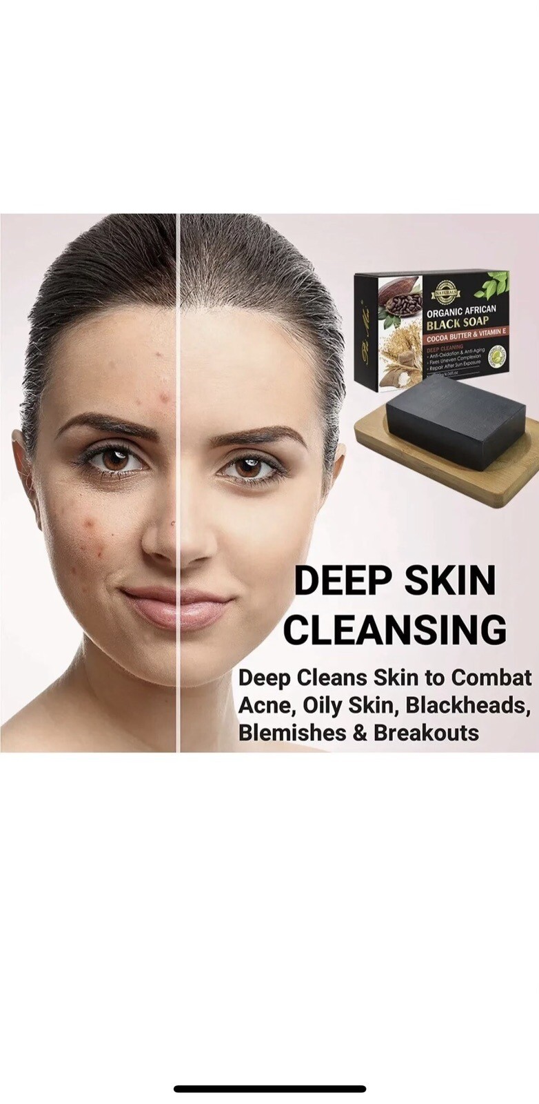 Organic African Black Soap Deep Cleaning Detoxifying Effect