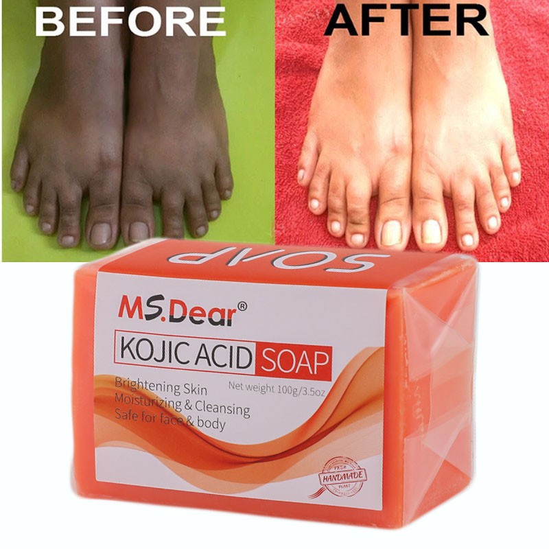 Kojic Acid Soap Dark Spot Whitening Turmeric Soap Skin Bleaching Lightening 100g