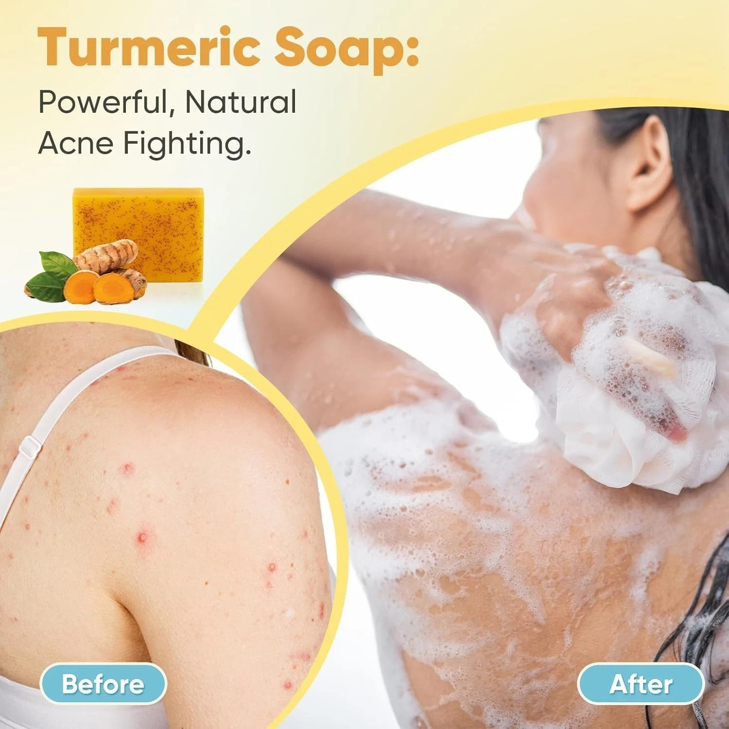 5 Jabones De Curcuma 3.5 oz Para Las Manchas El Acne En La Cara y Aclarar Piel