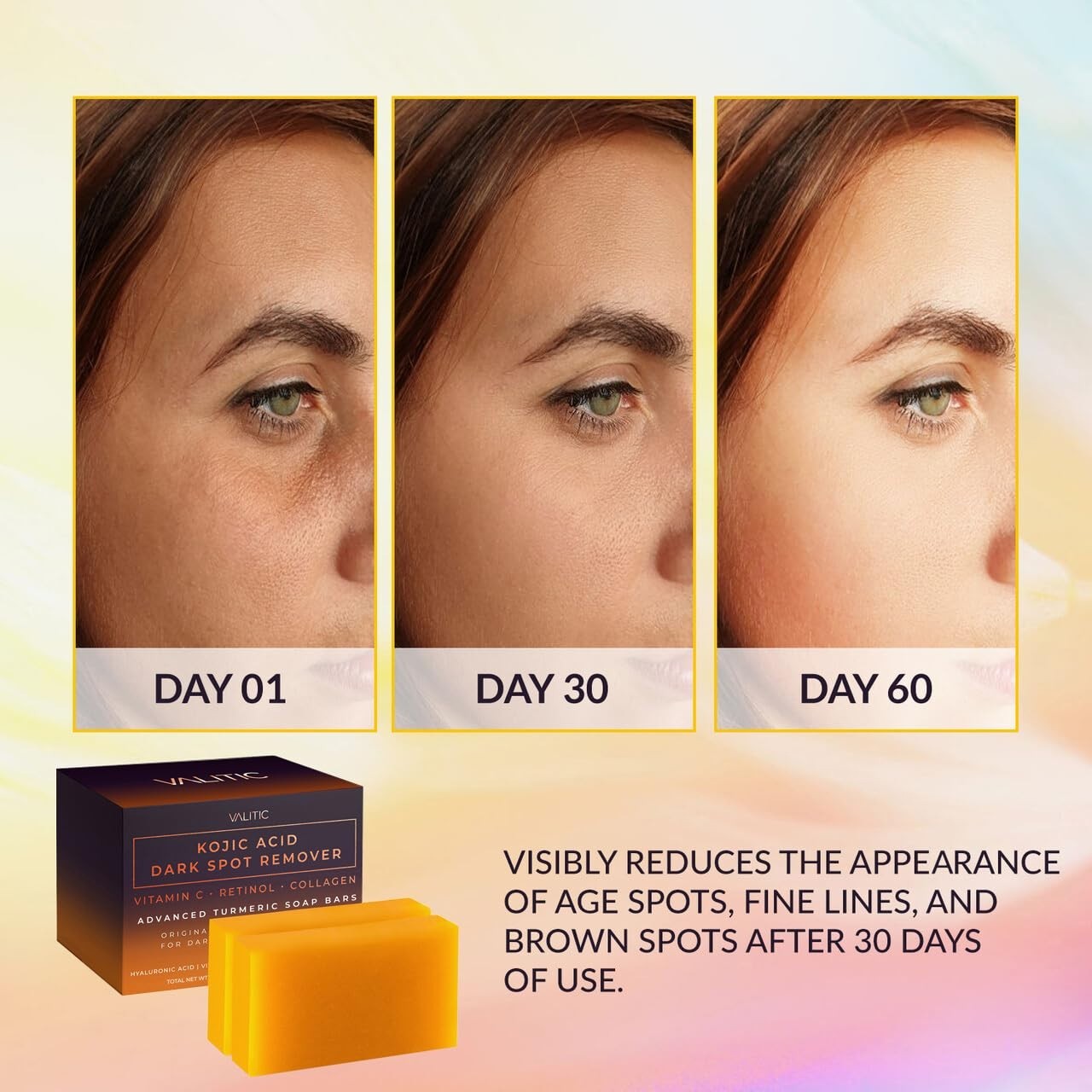 VALITIC Kojic Acid Dark Spot Remover Soap Bars with Vitamin C, Retinol, Collagen