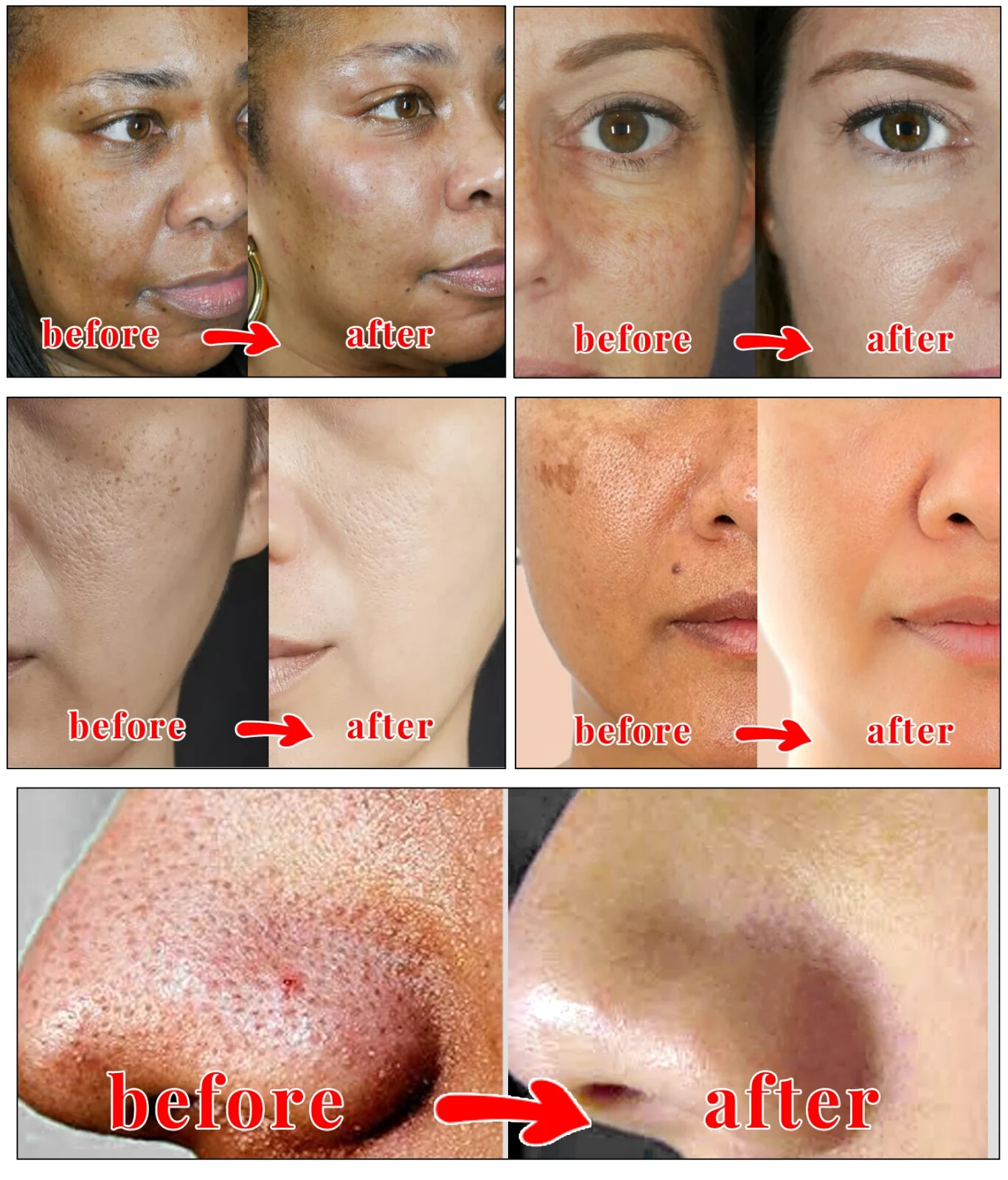 Original Kojie San Skin Lightening Kojic Acid Soap 65g x 2 Bars