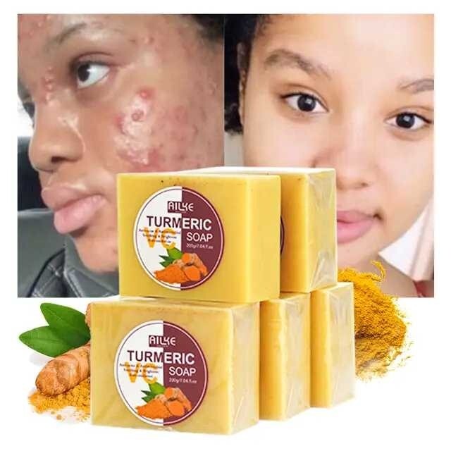 Turmeric Soap with Ginger, Vitamin C and Olive oil for all skin type (200g Bar)