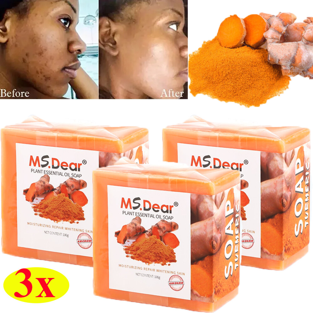 3×Tumeric Soap Ginger Anti-Acne Dark Spots Scars Removal Body Whitening Soap Bar
