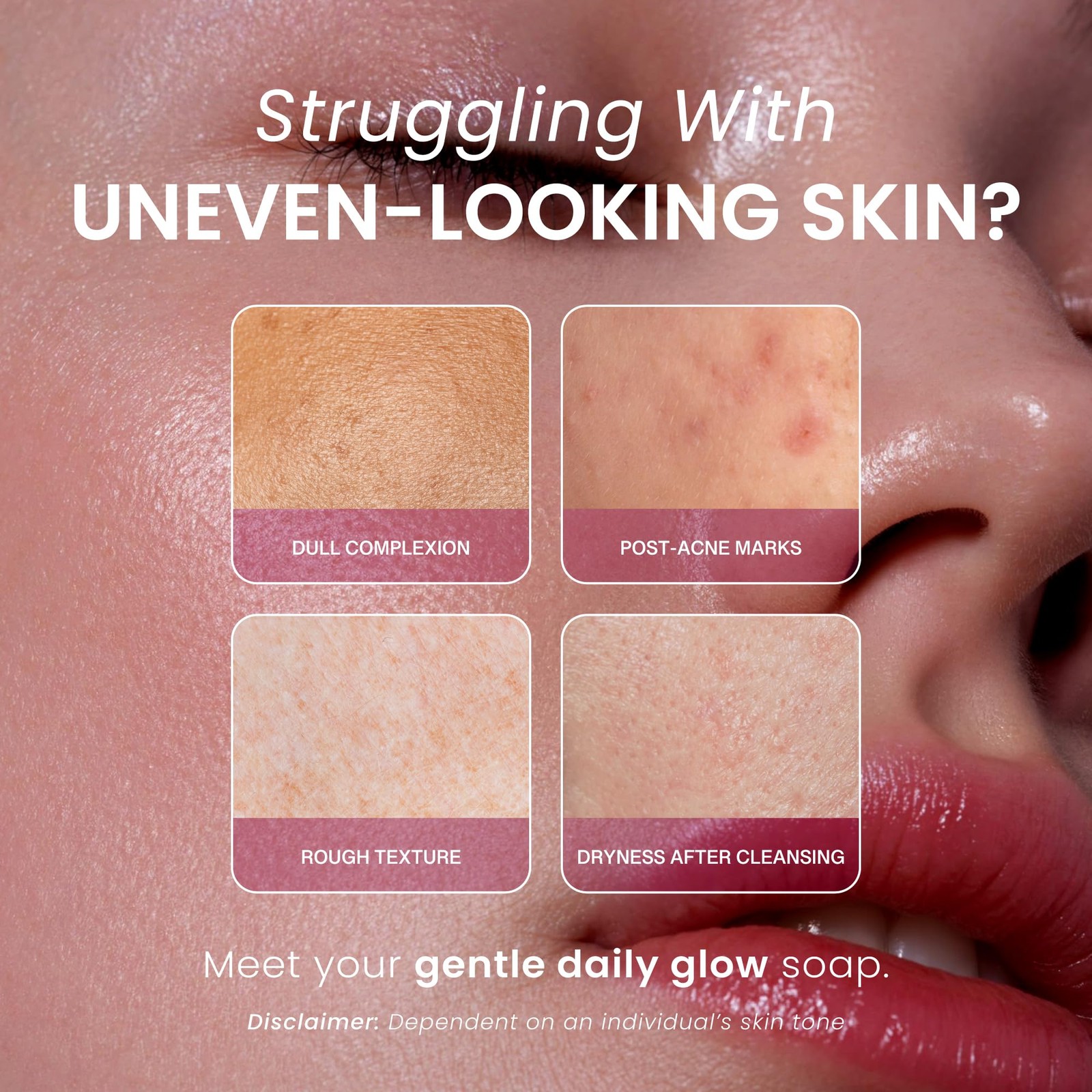 Kojic Acid & Collagen Skin Brightening Soap for & Natural Glowing Skin – Mois…