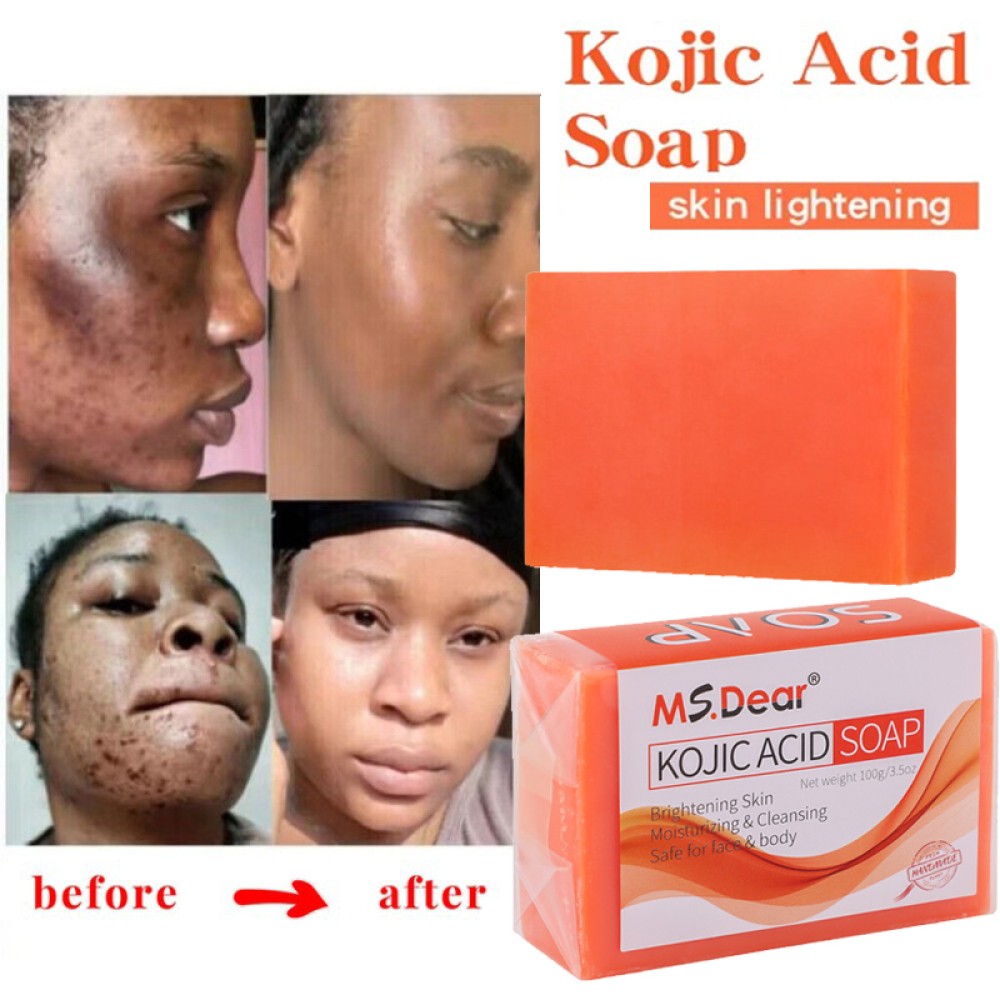 Turmeric Kojic Acid Brightening Soap Skin Whitening Dark Spot lightening Acne UK