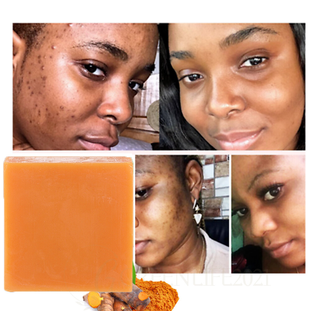 3PCS Tumeric Soap Skin Whitening Dark Spots lightening Acne Brightening Turmeric