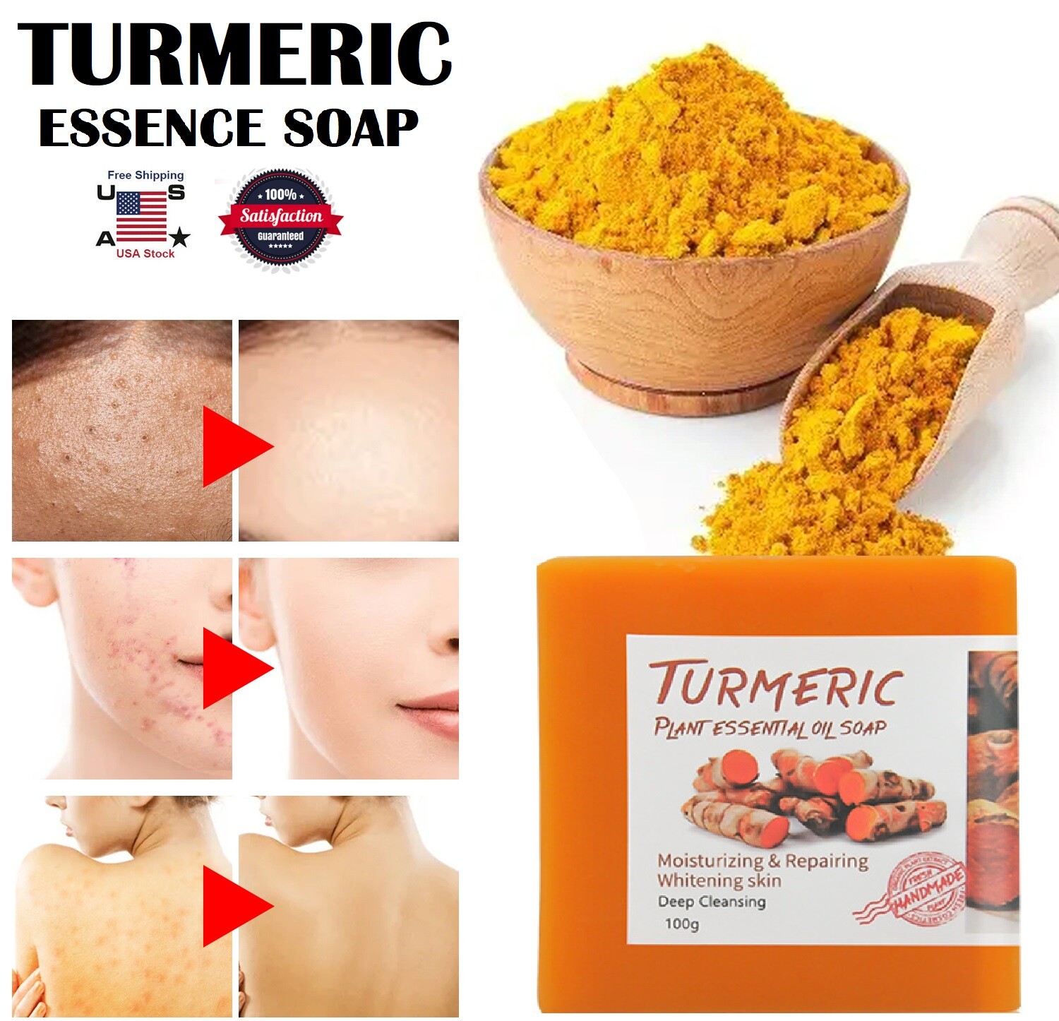 2× Tumeric Soap Skin Whitening Dark Spots lightening Acne Brightening Turmeric