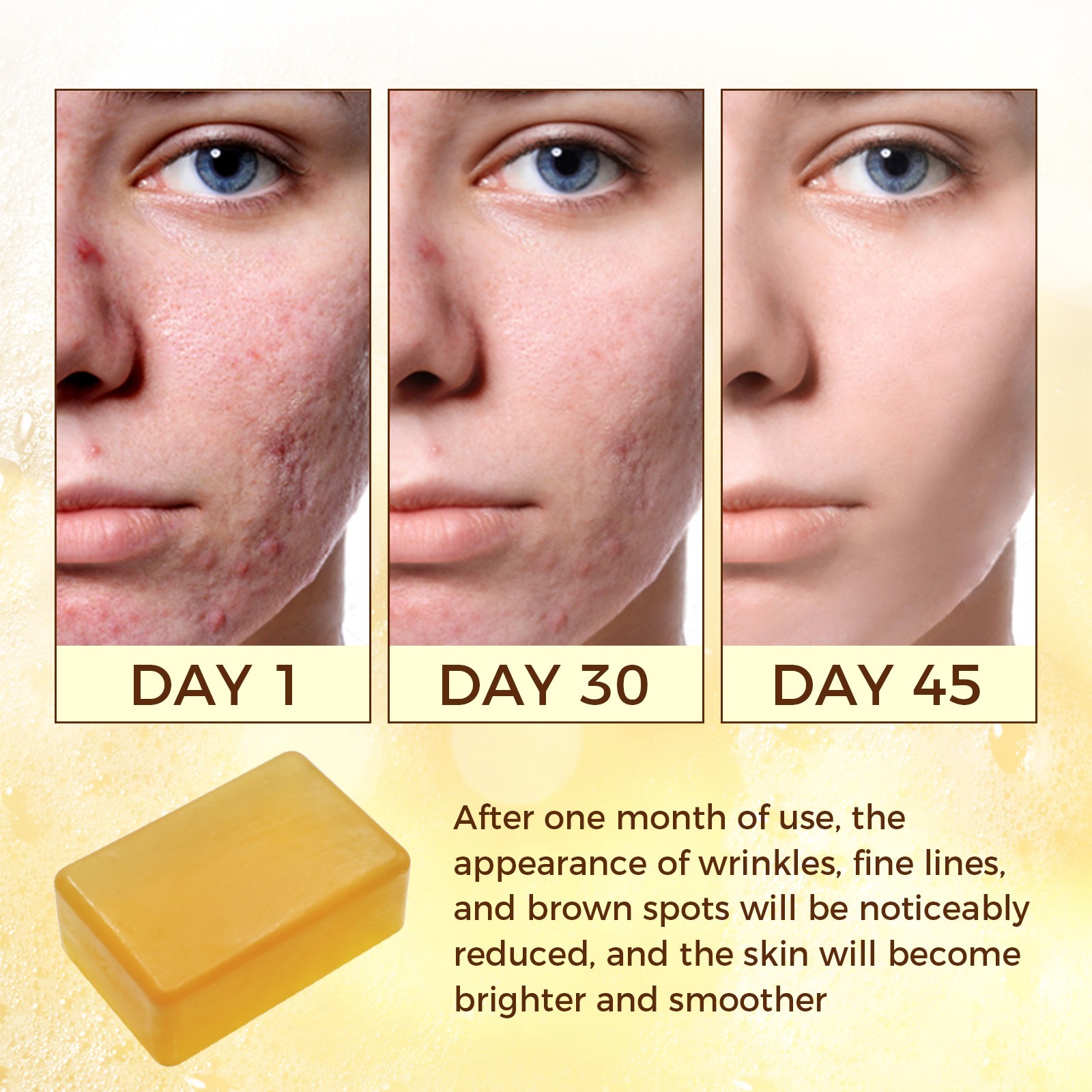 OUKEYA Turmeric Kojic Acid Soap, Skin Whitening Dark Spots lightening Acne 115g